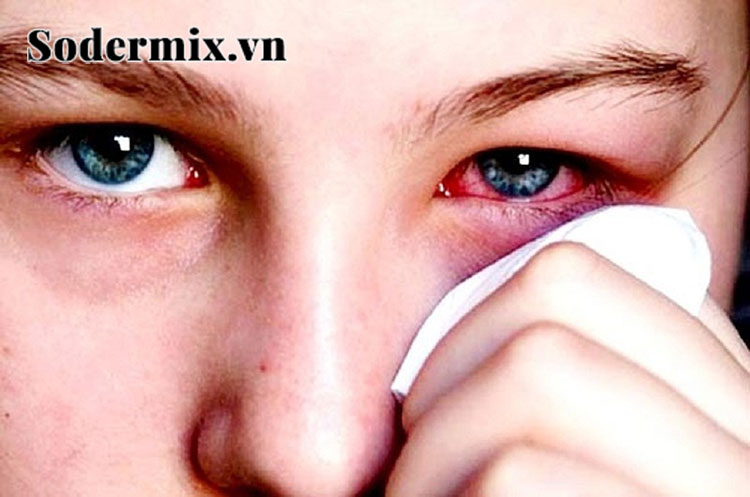 Ngứa mắt trái theo giờ là dấu hiệu cảnh báo các vấn đề về sức khỏe 1