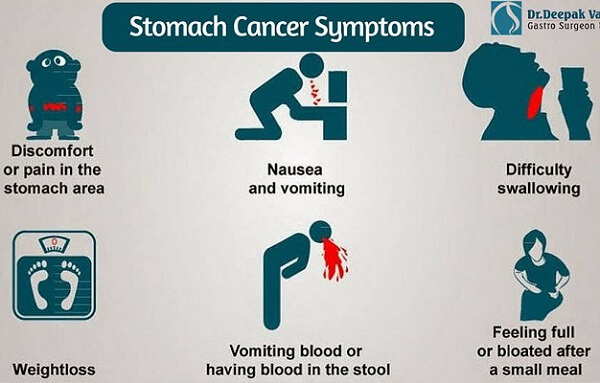 Ung thư dạ dày tiếng anh là gì: stomach cancer hoặc gastric cancer